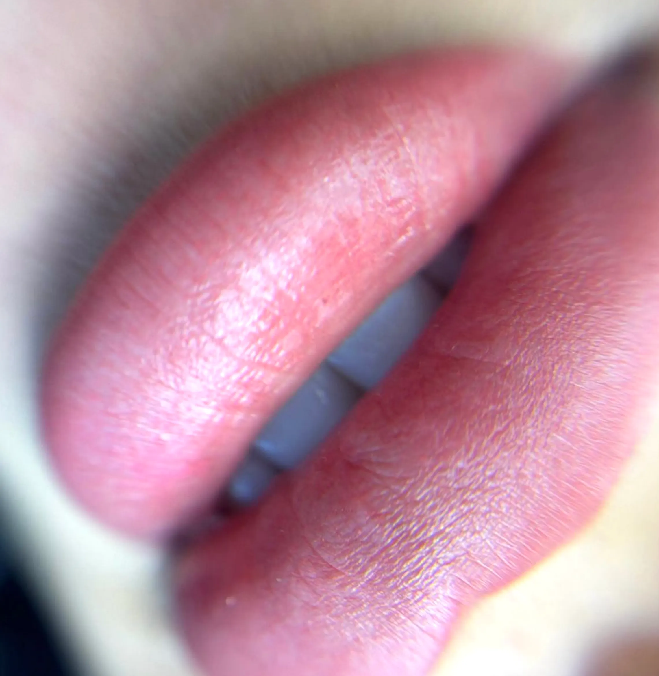 fixing botched lip tattoo