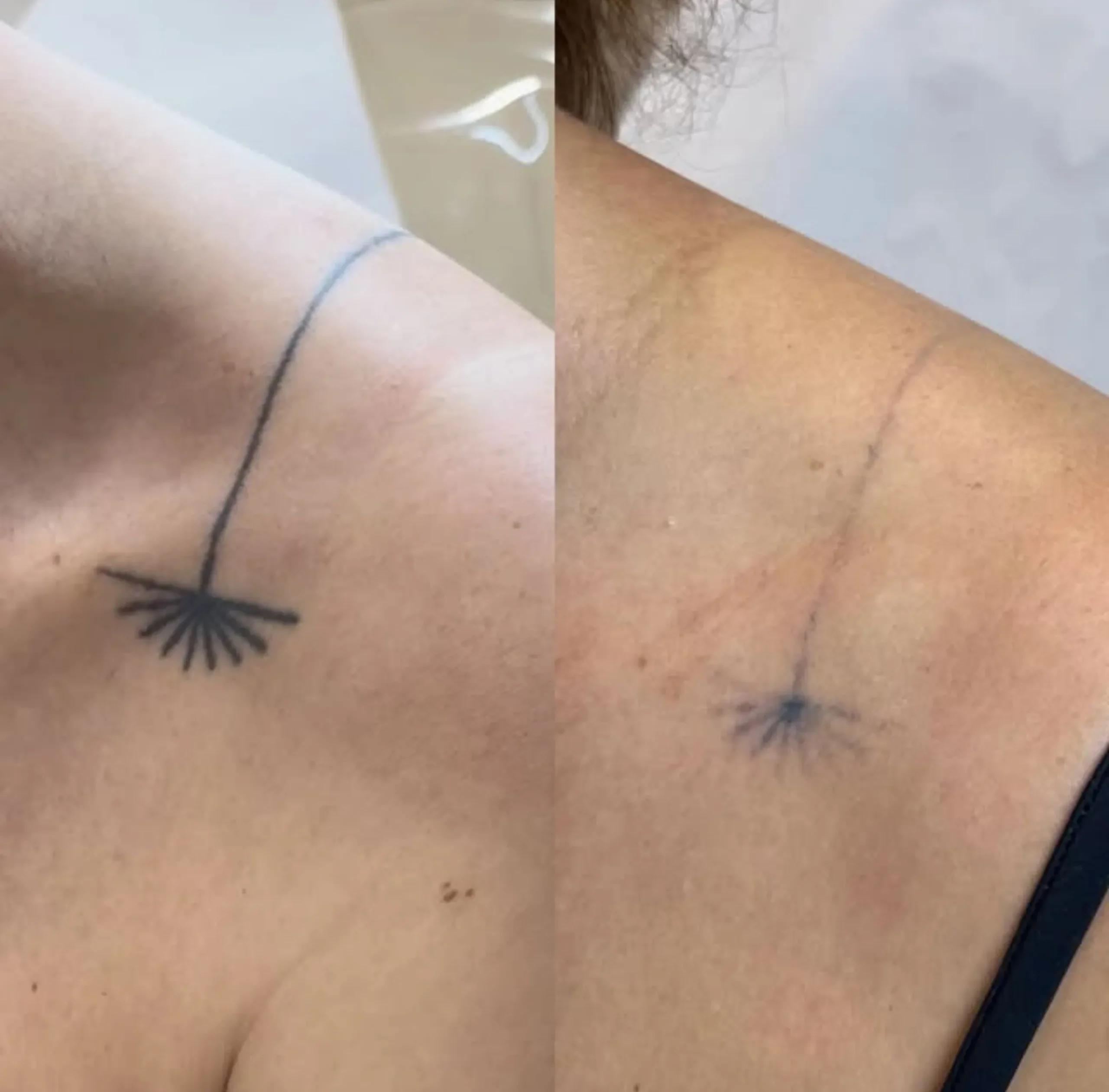 cosmetic tattoo ink patch testing